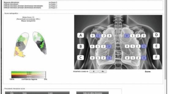 Assessing Trustworthy AI in times of COVID-19. Deep Learning for predicting a multi-regional score conveying the degree of lung compromise in COVID-19 patients